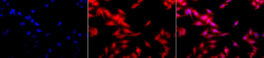 Immunocytochemistry/Immunofluorescence analysis using Rat Anti-HSF1 Monoclonal Antibody, Clone 10H8 (12518). Tissue: Heat Shocked cervical cancer cells (HeLa). Species: Human. Fixation: 2% Formaldehyde for 20 min at RT. Primary Antibody: Rat Anti-HSF1 Monoclonal Antibody (12518) at 1:100 for 12 hours at 4°C. Secondary Antibody: APC Goat Anti-Rat (red) at 1:200 for 2 hours at RT. Counterstain: DAPI (blue) nuclear stain at 1:40000 for 2 hours at RT. Localization: Diffuse nuclear and cytoplasmic staining. Magnification: 20x. (A) DAPI (blue) nuclear stain. (B) Anti-HSF1 Antibody. (C) Composite. Heat Shocked at 42°C for 1h.