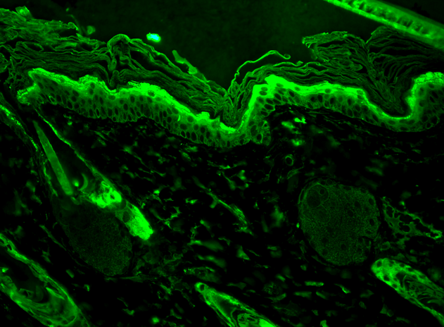 Immunohistochemistry analysis using Mouse Anti-Hsp27 Monoclonal Antibody, Clone 8A7 (11110). Tissue: backskin. Species: Mouse. Fixation: Bouin