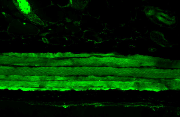 Immunohistochemistry analysis using Mouse Anti-Hsp27 Monoclonal Antibody, Clone 8A7 (11110). Tissue: backskin. Species: Mouse. Fixation: Bouin