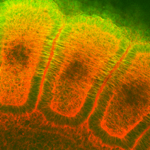 Immunohistochemistry analysis using Mouse Anti-Hsp27 Monoclonal Antibody, Clone 8A7 (11110). Tissue: embryo somites. Species: Rat. Primary Antibody: Mouse Anti-Hsp27 Monoclonal Antibody (11110) at 1:1000. Secondary Antibody: FITC Goat Anti-Mouse (green). Counterstain: Rhodamine-phalloidin labeled actin (red). Investigation at 11 days gestation. Courtesy of: Mike Welsh, Umich.