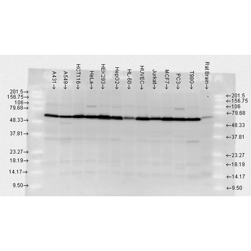 Western blot analysis of Human, Rat brain cell lysates showing detection of HSP70 protein using Rabbit Anti-HSP70 Polyclonal Antibody (11108). Load: 2 µg. Block: 1.5% BSA for 30 minutes at RT. Primary Antibody: Rabbit Anti-HSP70 Polyclonal Antibody (11108) at 1:10000 for 2 hours at RT. Secondary Antibody: Donkey Anti-Rabbit IgG: HRP for 1 hour at RT.