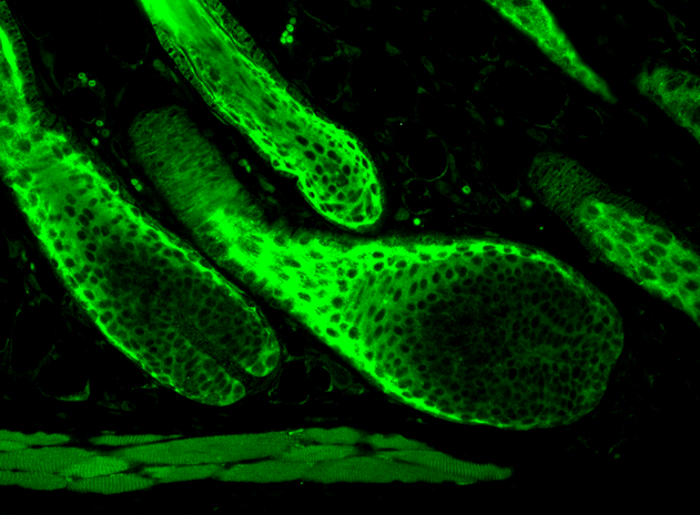 Immunohistochemistry analysis using Rabbit Anti-HSP70 Polyclonal Antibody (11108). Tissue: backskin. Species: Mouse. Fixation: Bouin