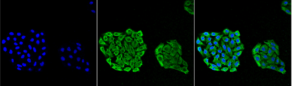 Immunocytochemistry/Immunofluorescence analysis using Mouse Anti-HSP70 Monoclonal Antibody, Clone 3A3 (11117). Tissue: Cervical cancer cell line (HeLa). Species: Human. Fixation: 4% Formaldehyde for 15 min at RT. Primary Antibody: Mouse Anti-HSP70 Monoclonal Antibody (11117) at 1:100 for 60 min at RT. Secondary Antibody: Goat Anti-Mouse ATTO 488 at 1:100 for 60 min at RT. Counterstain: DAPI (blue) nuclear stain at 1:5000 for 5 min RT. Localization: Cytoplasm. Magnification: 40X.