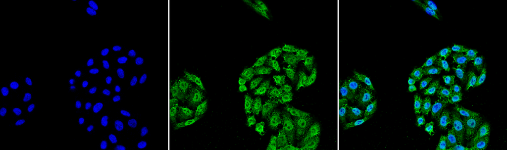 Immunocytochemistry/Immunofluorescence analysis using Mouse Anti-HSP70 Monoclonal Antibody, Clone 5A5 (11118). Tissue: Cervical cancer cell line (HeLa). Species: Human. Fixation: 4% Formaldehyde for 15 min at RT. Primary Antibody: Mouse Anti-HSP70 Monoclonal Antibody (11118) at 1:100 for 60 min at RT. Secondary Antibody: Goat Anti-Mouse ATTO 488 at 1:100 for 60 min at RT. Counterstain: DAPI (blue) nuclear stain at 1:5000 for 5 min RT. Localization: Nucleus, Cytoplasm. Magnification: 40X.