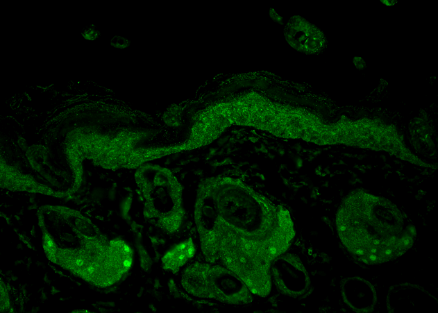 Immunohistochemistry analysis using Mouse Anti-Hsp70 Monoclonal Antibody, Clone N27F3-4 (11095). Tissue: backskin. Species: Mouse. Fixation: Bouin