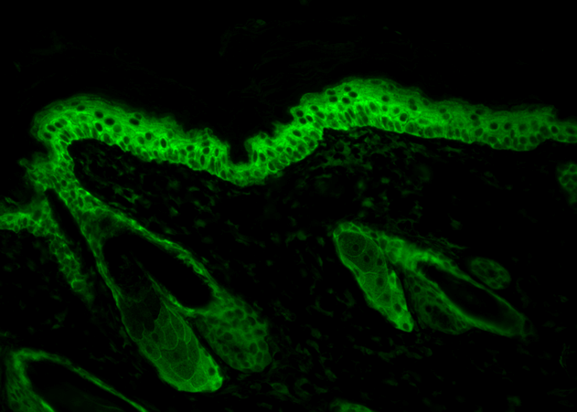 Immunohistochemistry analysis using Mouse Anti-Hsp90 Monoclonal Antibody, Clone H9010 (11098). Tissue: backskin. Species: Mouse. Fixation: Bouin