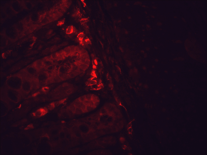 Immunohistochemistry analysis using Mouse Anti-Hsp90 Monoclonal Antibody, Clone H9010 (11098). Tissue: inflamed colon. Species: Mouse. Fixation: Formalin. Primary Antibody: Mouse Anti-Hsp90 Monoclonal Antibody (11098) at 1:10000 for 12 hours at 4°C. Secondary Antibody: Alexa Fluor 555 Goat Anti-Mouse (red) at 1:5000 for 1 hour at RT. Localization: Inflammatory and epithelial mucosa. Magnification: 40x. Inflammatory and epithelial mucosa. This image was produced using an amplifying IHC wash buffer. The antibody has therefore been diluted more than is recommended for other applications.