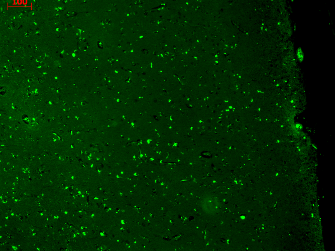 Immunohistochemistry analysis using Mouse Anti-KCNQ1 Monoclonal Antibody, Clone N37A/10 (11510). Tissue: hippocampus. Species: Human. Fixation: Bouin