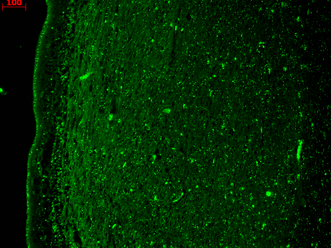 Immunohistochemistry analysis using Mouse Anti-KCNQ4 Monoclonal Antibody, Clone N43/6 (11512). Tissue: hippocampus. Species: Human. Fixation: Bouin