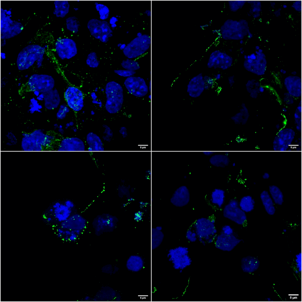 Immunocytochemistry/Immunofluorescence analysis using Mouse Anti-LRP4 Monoclonal Antibody, Clone S207-27 (56540). Tissue: COS cells transfected with 2 ug human LRP4 plasmid. Species: Human. Fixation: 4% PFA for 10 min. Primary Antibody: Mouse Anti-LRP4 Monoclonal Antibody (56540) at 1:100 for 1 hour at RT. Secondary Antibody: Goat anti-mouse: Alexa 488. Counterstain: DAPI.