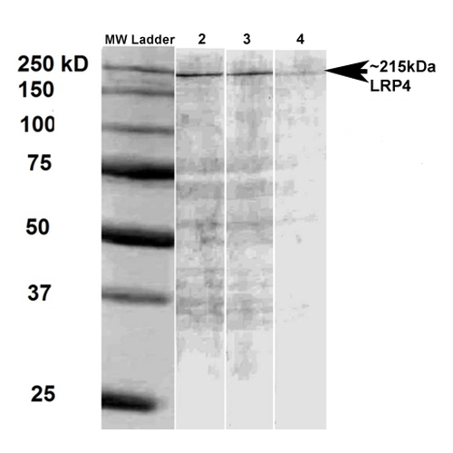 Western Blot analysis of Rat brain membrane lysate showing detection of LRP4 protein using Mouse Anti-LRP4 Monoclonal Antibody, Clone S207-27 (56540). Primary Antibody: Mouse Anti-LRP4 Monoclonal Antibody (56540) at 1:500, 1:1000, and 1:2000.