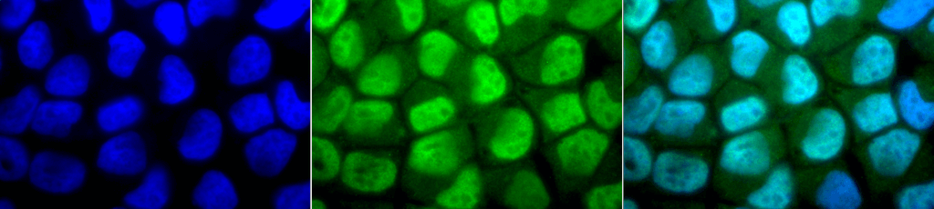 Immunocytochemistry/Immunofluorescence analysis using Rabbit Anti-Methylated Lysine Polyclonal Antibody (56499). Tissue: Cervical cancer cell line (HeLa). Species: Human. Fixation: 2% Formaldehyde for 20 min at RT. Primary Antibody: Rabbit Anti-Methylated Lysine Polyclonal Antibody (56499) at 1:50 for 12 hours at 4°C. Secondary Antibody: FITC Goat Anti-Rabbit (green) at 1:200 for 2 hours at RT. Counterstain: DAPI (blue) nuclear stain at 1:40000 for 2 hours at RT. Localization: Nucleus. Cytoplasm. Magnification: 100x. (A) DAPI (blue) nuclear stain. (B) Anti-Methylated Lysine Antibody. (C) Composite.