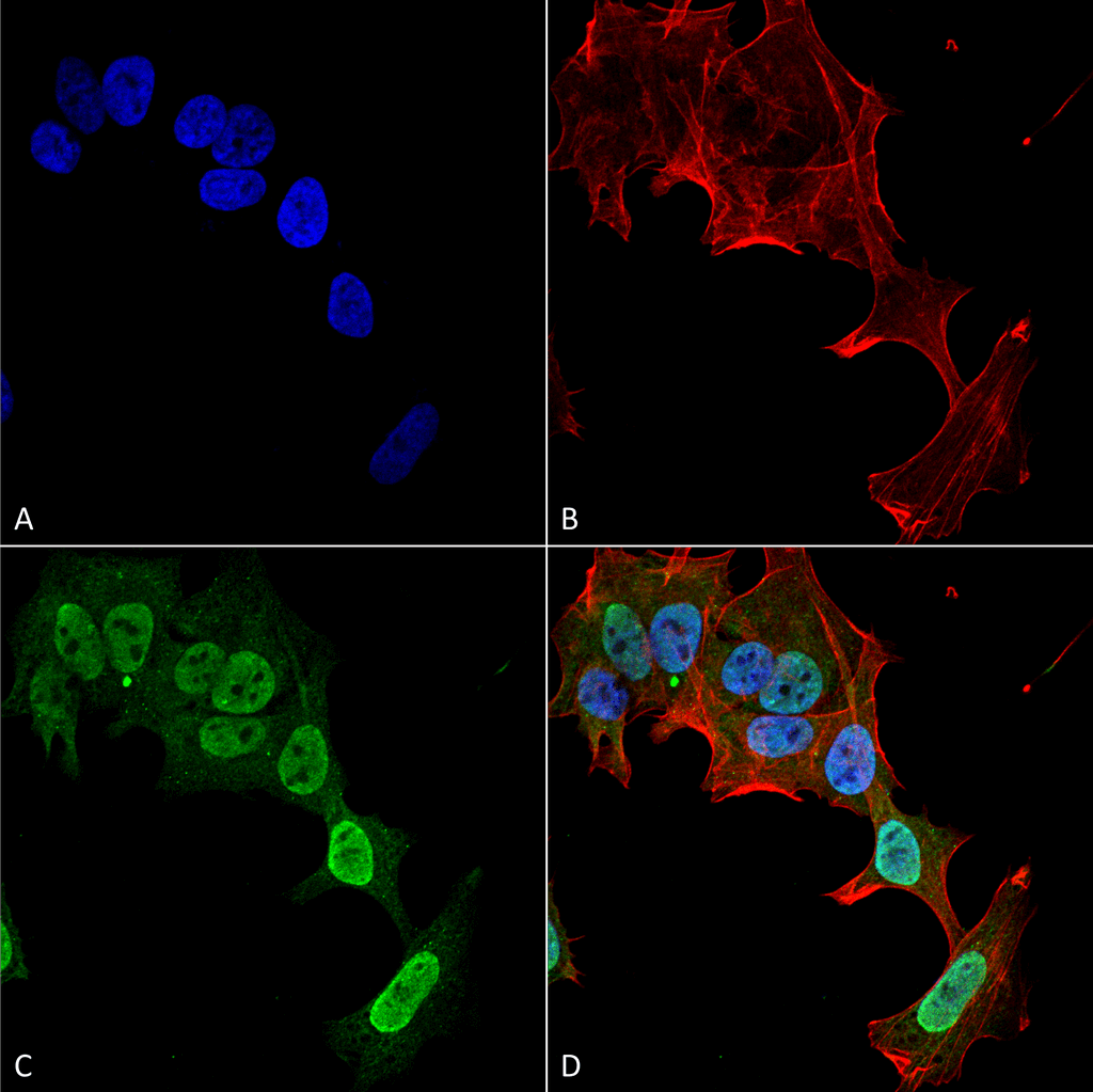 Immunocytochemistry/Immunofluorescence analysis using Mouse Anti-mGluR1/5 Monoclonal Antibody, Clone S75-33 (56526). Tissue: Neuroblastoma cell line (SK-N-BE). Species: Human. Fixation: 4% Formaldehyde for 15 min at RT. Primary Antibody: Mouse Anti-mGluR1/5 Monoclonal Antibody (56526) at 1:100 for 60 min at RT. Secondary Antibody: Goat Anti-Mouse ATTO 488 at 1:200 for 60 min at RT. Counterstain: Phalloidin Texas Red F-Actin stain; DAPI (blue) nuclear stain at 1:1000, 1:5000 for 60 min at RT, 5 min at RT. Localization: Cell Membrane, Cytoplasm, Nucleus. Magnification: 60X. (A) DAPI (blue) nuclear stain. (B) Phalloidin Texas Red F-Actin stain. (C) mGluR1/5 Antibody. (D) Composite.