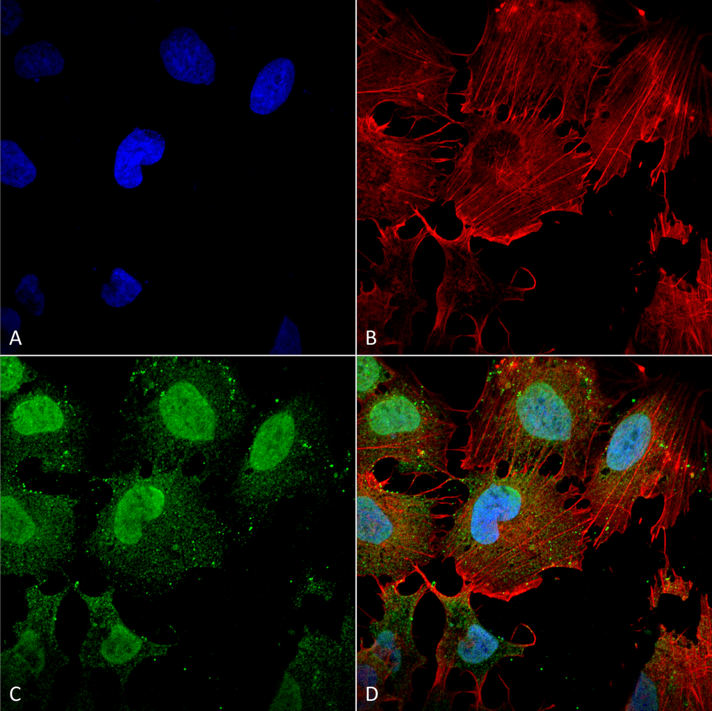 Immunocytochemistry/Immunofluorescence analysis using Mouse Anti-mGluR1/5 glutamate receptor Monoclonal Antibody, Clone S75-3 (56545). Tissue: Neuroblastoma cell line (SK-N-BE). Species: Human. Fixation: 4% Formaldehyde for 15 min at RT. Primary Antibody: Mouse Anti-mGluR1/5 glutamate receptor Monoclonal Antibody (56545) at 1:100 for 60 min at RT. Secondary Antibody: Goat Anti-Mouse ATTO 488 at 1:200 for 60 min at RT. Counterstain: Phalloidin Texas Red F-Actin stain; DAPI (blue) nuclear stain at 1:1000, 1:5000 for 60 min at RT, 5 min at RT. Localization: Cell Membrane, Cytoplasm, Nucleus. Magnification: 60X. (A) DAPI (blue) nuclear stain. (B) Phalloidin Texas Red F-Actin stain. (C) mGluR1/5 glutamate receptor Antibody. (D) Composite.