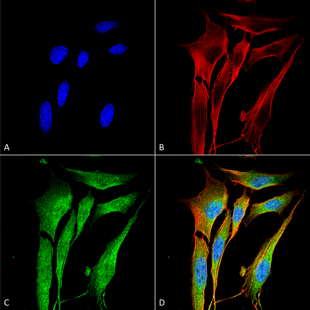 Immunocytochemistry/Immunofluorescence analysis using Mouse Anti-MMP9 Monoclonal Antibody, Clone S51-82 (29022). Tissue: NIH 3T3 (NIH 3T3). Species: Mouse. Fixation: 4% Formaldehyde for 15 min at RT. Primary Antibody: Mouse Anti-MMP9 Monoclonal Antibody (29022) at 1:100 for 60 min at RT. Secondary Antibody: Goat Anti-Mouse ATTO 488 at 1:200 for 60 min at RT. Counterstain: Phalloidin Texas Red F-Actin stain; DAPI (blue) nuclear stain at 1:1000, 1:5000 for 60 min at RT, 5 min at RT. Localization: Cytoplasm . Magnification: 60X. (A) DAPI (blue) nuclear stain. (B) Phalloidin Texas Red F-Actin stain. (C) MMP9 Antibody. (D) Composite.