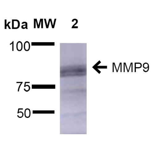 Western Blot analysis of Rat Brain showing detection of ~92 kDa and ~82 kDa (pro and active) MMP9 protein using Mouse Anti-MMP9 Monoclonal Antibody, Clone S51-82 (29022). Lane 1: Molecular Weight Ladder (MW). Lane 2: Rat Brain. Load: 15 µg. Block: 5% Skim Milk in 1X TBST. Primary Antibody: Mouse Anti-MMP9 Monoclonal Antibody (29022) at 1:1000 for 2 hours at RT. Secondary Antibody: Goat Anti-Mouse IgG: HRP at 1:2000 for 60 min at RT. Color Development: ECL solution for 5 min at RT. Predicted/Observed Size: ~92 kDa and ~82 kDa (pro and active).