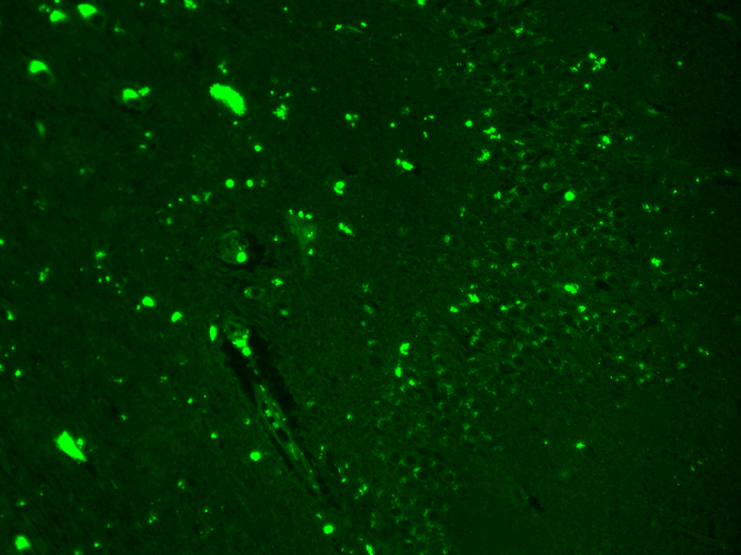 Immunohistochemistry analysis using Mouse Anti-Nav1.7 Sodium Channel Monoclonal Antibody, Clone N68/6 (11517). Tissue: hippocampus. Species: Human. Fixation: Bouin