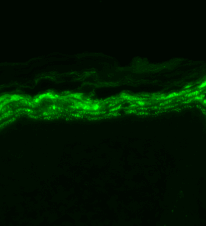 Immunohistochemistry analysis using Mouse Anti-Nav1.7 Sodium Channel Monoclonal Antibody, Clone N68/6 (11517). Tissue: backskin. Species: Mouse. Fixation: Bouin