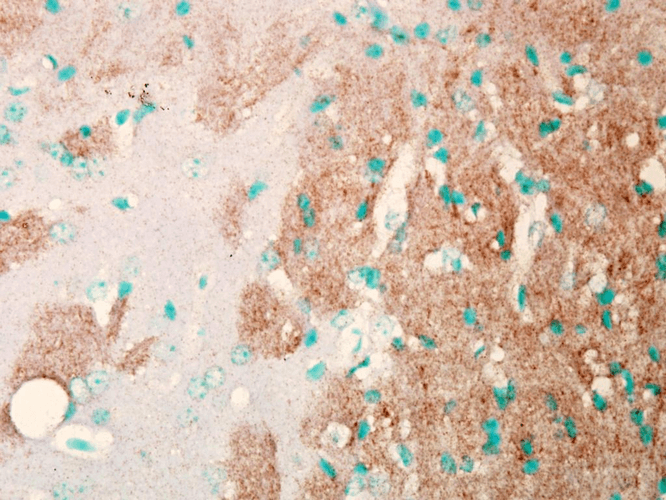 Immunohistochemistry analysis using Mouse Anti-Nav1.7 Sodium Channel Monoclonal Antibody, Clone N68/6 (11517). Tissue: Brain Slice. Species: Mouse. Fixation: Frozen sections. Primary Antibody: Mouse Anti-Nav1.7 Sodium Channel Monoclonal Antibody (11517) at 1:1000. Secondary Antibody: HRP/DAB Detection System: Biotinylated Goat Anti-Mouse, Streptavidin Peroxidase, DAB Chromogen (brown). Counterstain: Mayer Hematoxylin (purple/blue) nuclear stain.