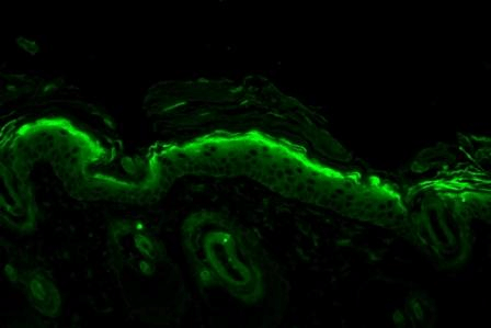 Immunohistochemistry analysis using Mouse Anti-Nitrotyrosine Monoclonal Antibody, Clone 39B6 (56456). Tissue: backskin. Species: Mouse. Fixation: Bouin