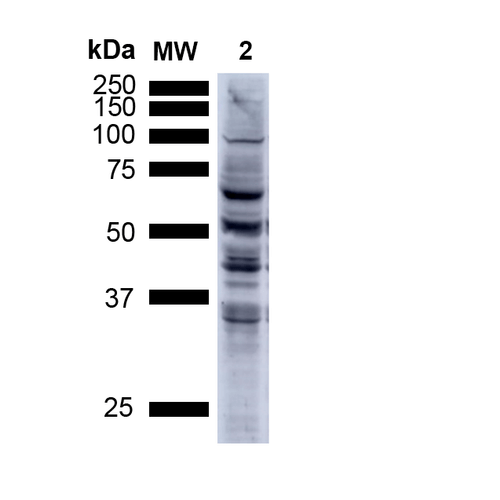 Western Blot analysis of Human A549 cells showing detection of Multiple Bands Nitrotyrosine protein using Mouse Anti-Nitrotyrosine Monoclonal Antibody, Clone 39B6 (56456). Lane 1: MW ladder. Lane 2: Human A549 Cells 15 ug). Load: 15 ug. Block: 5% Skim Milk Powder in TBST. Primary Antibody: Mouse Anti-Nitrotyrosine Monoclonal Antibody (56456) at 1:1000 for 2.5 hours at RT with shaking . Secondary Antibody: Goat anti-mouse IgG:HRP at 1:1000 for 1 hour at RT with shaking . Color Development: Chemiluminescent for HRP (Moss) for 5 min in RT. Predicted/Observed Size: Multiple Bands.