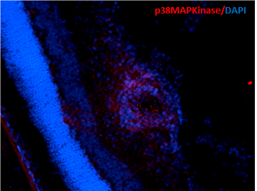 Immunohistochemistry analysis using Mouse Anti-p38 MAPK Monoclonal Antibody, Clone 9F12 (56450). Tissue: Retinal Injury Model. Species: Mouse. Primary Antibody: Mouse Anti-p38 MAPK Monoclonal Antibody (56450) at 1:1000. Secondary Antibody: Alexa Fluor 594 Goat Anti-Mouse (red). Courtesy of: Dr. Rajashekhar Gangaraju, University of Indiana, Department of Ophthalmology, Eugene and Marilyn Glick Eye Institute.