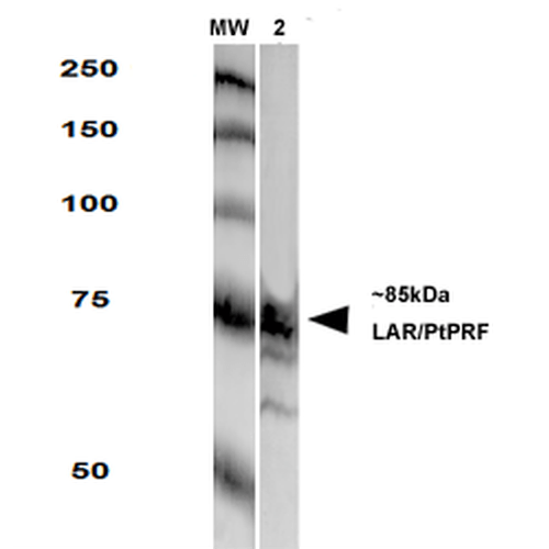 Western Blot analysis of Rat Brain Membrane showing detection of LAR protein using Mouse Anti-LAR Monoclonal Antibody, Clone S165-38 (56579). Primary Antibody: Mouse Anti-LAR Monoclonal Antibody (56579) at 1:250.