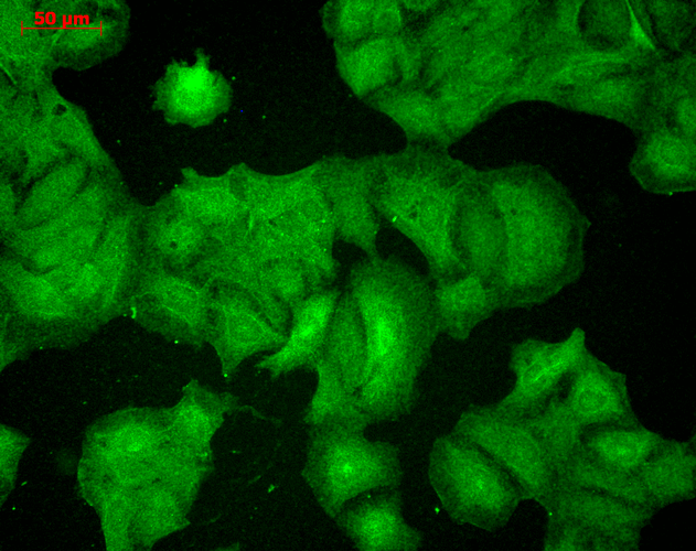 Immunocytochemistry/Immunofluorescence analysis using Mouse Anti-PSD95 Monoclonal Antibody, Clone 7E3 (56457). Tissue: HaCaT cells. Species: Human. Fixation: Cold 100% methanol for 10 minutes at -20°C. Primary Antibody: Mouse Anti-PSD95 Monoclonal Antibody (56457) at 1:100 for 1 hour at RT. Secondary Antibody: FITC Goat Anti-Mouse (green) at 1:50 for 1 hour at RT. Localization: Filamentous-like staining.