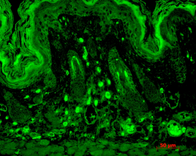 Immunohistochemistry analysis using Mouse Anti-PSD95 Monoclonal Antibody, Clone 7E3 (56457). Tissue: backskin. Species: Mouse. Fixation: Bouin