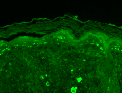 Immunohistochemistry analysis using Mouse Anti-SHANK3 Monoclonal Antibody, Clone S69-46 (56463). Tissue: backskin. Species: Mouse. Fixation: Bouin