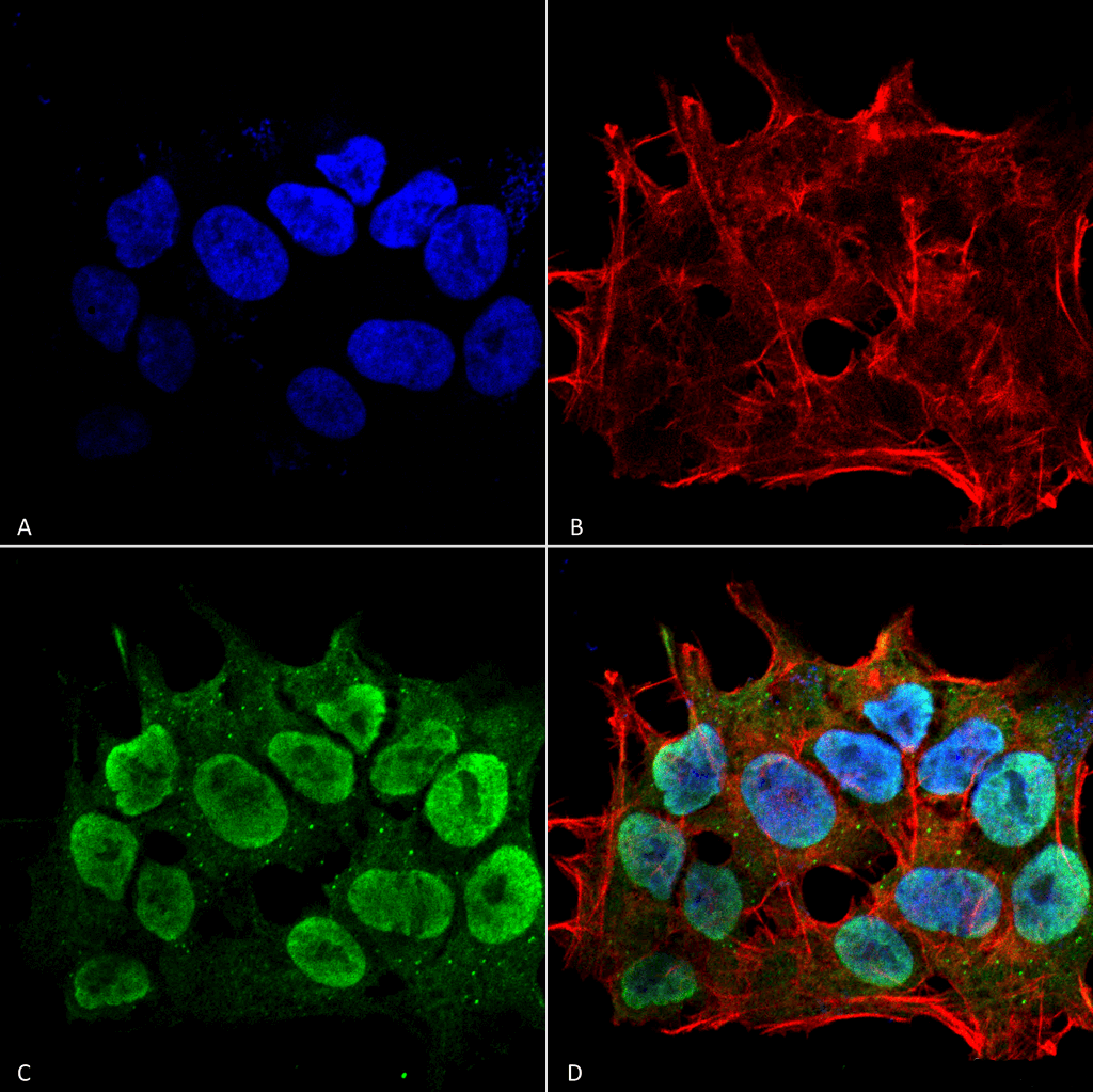 Immunocytochemistry/Immunofluorescence analysis using Mouse Anti-SHANK1/SHANK3 Monoclonal Antibody, Clone S367-51 (56578). Tissue: Neuroblastoma cell line (SK-N-BE). Species: Human. Fixation: 4% Formaldehyde for 15 min at RT. Primary Antibody: Mouse Anti-SHANK1/SHANK3 Monoclonal Antibody (56578) at 1:100 for 60 min at RT. Secondary Antibody: Goat Anti-Mouse ATTO 488 at 1:100 for 60 min at RT. Counterstain: Phalloidin Texas Red F-Actin stain; DAPI (blue) nuclear stain at 1:1000; 1:5000 for 60 min RT, 5 min RT. Localization: Cytoplasm, Nucleus. Magnification: 60X. (A) DAPI (blue) nuclear stain. (B) Phalloidin Texas Red F-Actin stain. (C) SHANK1/SHANK3 Antibody. (D) Composite.
