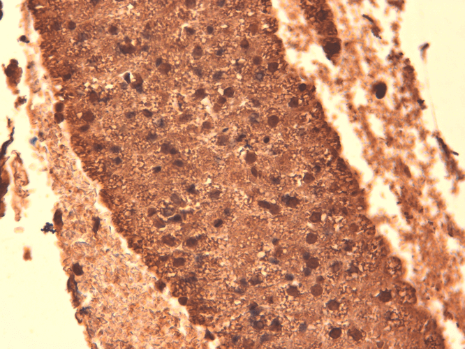 Immunohistochemistry analysis using Mouse Anti-Sodium Iodide Symporter Monoclonal Antibody, Clone 14F (11562). Tissue: Thyroid. Species: Mouse. Fixation: 10% Formalin Solution for 12-24 hours at RT. Primary Antibody: Mouse Anti-Sodium Iodide Symporter Monoclonal Antibody (11562) at 1:1000 for 1 hour at RT. Secondary Antibody: HRP/DAB Detection System: Biotinylated Goat Anti-Mouse, Streptavidin Peroxidase, DAB Chromogen (brown) for 30 minutes at RT. Counterstain: Mayer Hematoxylin (purple/blue) nuclear stain at 250-500 µl for 5 minutes at RT.