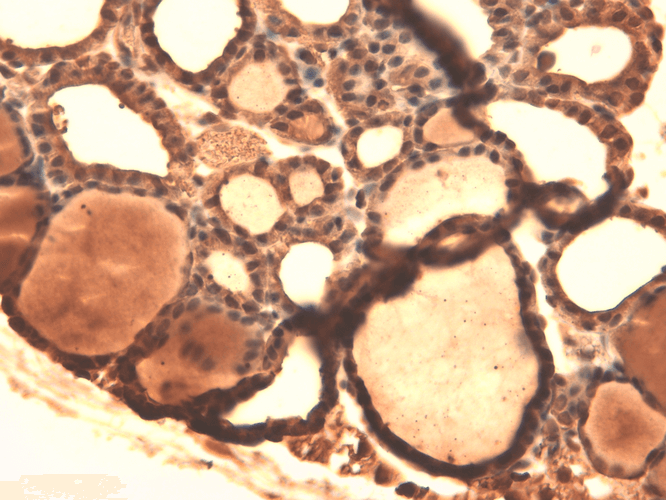 Immunohistochemistry analysis using Mouse Anti-Sodium Iodide Symporter Monoclonal Antibody, Clone 14F (11562). Tissue: Thyroid. Species: Mouse. Fixation: 10% Formalin Solution for 12-24 hours at RT. Primary Antibody: Mouse Anti-Sodium Iodide Symporter Monoclonal Antibody (11562) at 1:1000 for 1 hour at RT. Secondary Antibody: HRP/DAB Detection System: Biotinylated Goat Anti-Mouse, Streptavidin Peroxidase, DAB Chromogen (brown) for 30 minutes at RT. Counterstain: Mayer Hematoxylin (purple/blue) nuclear stain at 250-500 µl for 5 minutes at RT.