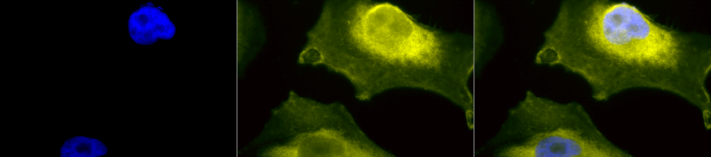Immunocytochemistry/Immunofluorescence analysis using Rabbit Anti-SOD1 (UBB) Polyclonal Antibody (13065). Tissue: Cervical cancer cell line (HeLa). Species: Human. Fixation: 2% Formaldehyde for 20 min at RT. Primary Antibody: Rabbit Anti-SOD1 (UBB) Polyclonal Antibody (13065) at 1:110 for 12 hours at 4°C. Secondary Antibody: R-PE Goat Anti-Rabbit (yellow) at 1:200 for 2 hours at RT. Counterstain: DAPI (blue) nuclear stain at 1:40000 for 2 hours at RT. Localization: Cytoplasm. Nucleus. Mitochondrion. Magnification: 100x. (A) DAPI (blue) nuclear stain. (B) Anti-SOD1 (UBB) Antibody. (C) Composite.