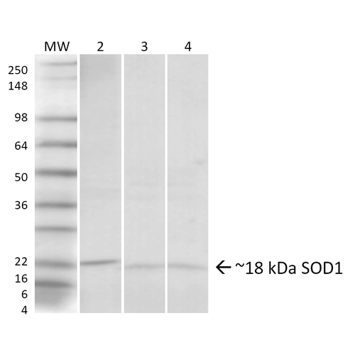 Western blot analysis of Human, Rat, Mouse Hela cells, Brain, Lung showing detection of ~18 kDa SOD1 (UBB) protein using Rabbit Anti-SOD1 (UBB) Polyclonal Antibody (13065). Lane 1: Molecular Weight Ladder. Lane 2: Human HeLa Cell Lysates. Lane 3: Rat Brain. Lane 4: Mouse Lung. Load: 20 µg. Primary Antibody: Rabbit Anti-SOD1 (UBB) Polyclonal Antibody (13065) at 1:1000. Predicted/Observed Size: ~18 kDa.