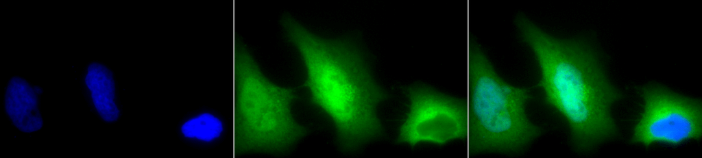Immunocytochemistry/Immunofluorescence analysis using Rabbit Anti-SOD (Cu/Zn) Polyclonal Antibody (13001). Tissue: Cervical cancer cell line (HeLa). Species: Human. Fixation: 2% Formaldehyde for 20 min at RT. Primary Antibody: Rabbit Anti-SOD (Cu/Zn) Polyclonal Antibody (13001) at 1:120 for 12 hours at 4°C. Secondary Antibody: FITC Goat Anti-Rabbit (green) at 1:200 for 2 hours at RT. Counterstain: DAPI (blue) nuclear stain at 1:40000 for 2 hours at RT. Localization: Cytoplasm. Nucleus. Magnification: 100x. (A) DAPI (blue) nuclear stain. (B) Anti-SOD (Cu/Zn) Antibody. (C) Composite.