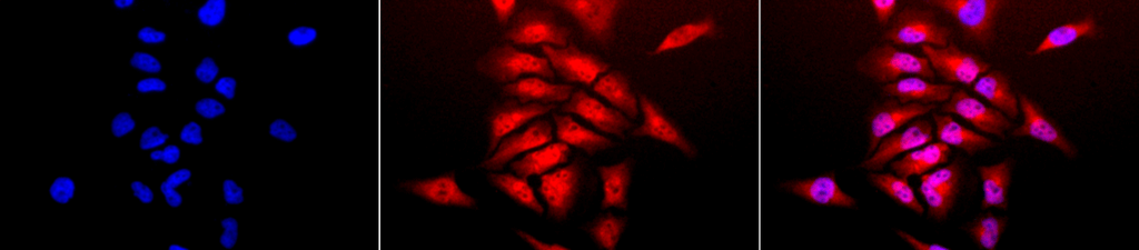 Immunocytochemistry/Immunofluorescence analysis using Rabbit Anti-SOD (Cu/Zn) Polyclonal Antibody (13001). Tissue: Cervical cancer cell line (HeLa). Species: Human. Fixation: 2% Formaldehyde for 20 min at RT. Primary Antibody: Rabbit Anti-SOD (Cu/Zn) Polyclonal Antibody (13001) at 1:120 for 12 hours at 4°C. Secondary Antibody: APC Goat Anti-Rabbit (red) at 1:200 for 2 hours at RT. Counterstain: DAPI (blue) nuclear stain at 1:40000 for 2 hours at RT. Localization: Cytoplasm. Nucleus. Magnification: 20x. (A) DAPI (blue) nuclear stain. (B) Anti-SOD (Cu/Zn) Antibody. (C) Composite.
