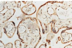 Immunohistochemistry analysis using Rabbit Anti-SOD1 Polyclonal Antibody (13002). Tissue: Placenta. Species: Human. Primary Antibody: Rabbit Anti-SOD1 Polyclonal Antibody (13002) at 1:100. Courtesy of: Courtesy of Joan Telfer, University of Glasgow.