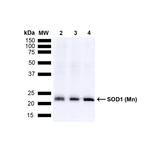 Western blot analysis of Mouse Brain, Rat Brain, and Rat Brain Membrane showing detection of 24.7kDa SOD (Mn) protein using Rabbit Anti-SOD (Mn) Polyclonal Antibody (13003). Lane 1: MW Ladder. Lane 2: Mouse Brain (15 µg). Lane 3: Rat Brain (15 µg). Lane 4: Rat Brain Membrane (15 µg). Block: 5% Skim Milk powder in TBST. Primary Antibody: Rabbit Anti-SOD (Mn) Polyclonal Antibody (13003) at 1:1000 for O/N at 4C. Secondary Antibody: Goat anti-rabbit IgG:HRP at 1:5000 for 1 hour at RT with shaking. Color Development: Chemiluminescent for HRP (Moss) for 5 min in RT. Predicted/Observed Size: 24.7kDa.