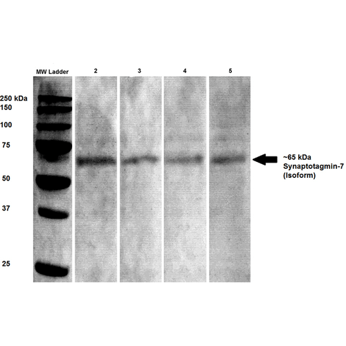 Western Blot analysis of Rat brain lysates showing detection of Synaptotagmin 7 protein using Mouse Anti-Synaptotagmin 7 Monoclonal Antibody, Clone S275-14 (56533). Primary Antibody: Mouse Anti-Synaptotagmin 7 Monoclonal Antibody (56533) at 1:100, 1:250, 1:500, and 1:1000.