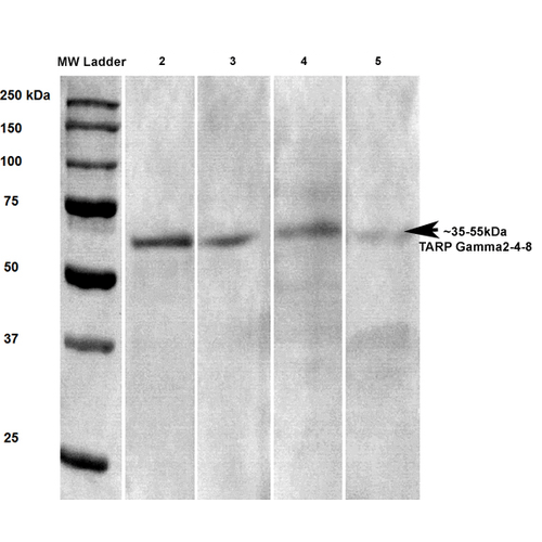Western Blot analysis of Rat brain lysates showing detection of Stargazin Calcium Channel protein using Mouse Anti-Stargazin Calcium Channel Monoclonal Antibody, Clone S245-36 (11572). Primary Antibody: Mouse Anti-Stargazin Calcium Channel Monoclonal Antibody (11572) at 1:100, 1:250, 1:500, and 1:1000.