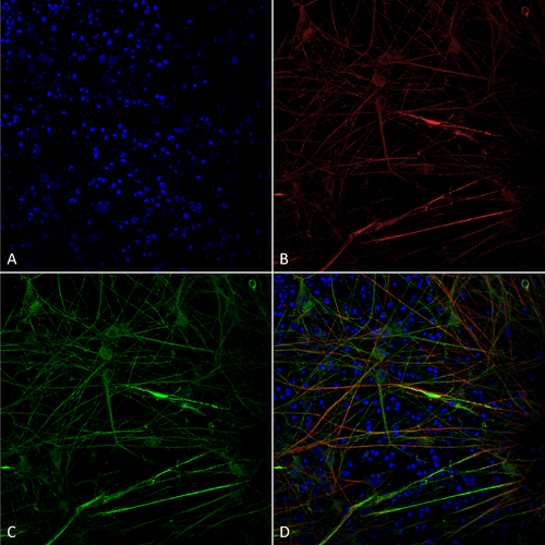 munocytochemistry/Immunofluorescence analysis using Mouse Anti-Tau Monoclonal Antibody, Clone 1D5 (57012). Tissue: iPSC-derived neurons. Species: Human. Fixation: 4% PFA. Primary Antibody: Mouse Anti-Tau Monoclonal Antibody (57012) at 1:100 for Overnight at 4°C. Counterstain: DAPI at 1:5000 for 5 minutes at RT in the dark. Magnification: 40X. Courtesy of: Francesco Paonessa.