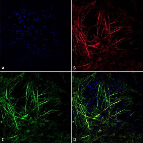 Immunocytochemistry/Immunofluorescence analysis using Mouse Anti-Tau Monoclonal Antibody, Clone 3D4 (57013). Tissue: iPSC-derived neurons. Species: Human. Fixation: 4% PFA. Primary Antibody: Mouse Anti-Tau Monoclonal Antibody (57013) at 1:100 for Overnight at 4°C. Counterstain: DAPI at 1:5000 for 5 minutes at RT in the dark. Magnification: 40X. Courtesy of: Francesco Paonessa.