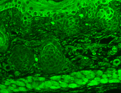 Immunohistochemistry analysis using Mouse Anti-TrpC7 Monoclonal Antibody, Clone N64A/36 (11522). Tissue: backskin. Species: Mouse. Fixation: Bouin