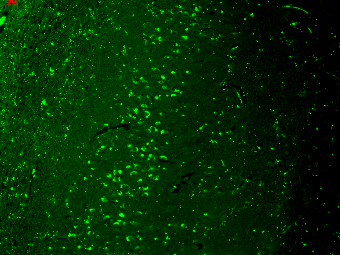 Immunohistochemistry analysis using Mouse Anti-TrpV3 Monoclonal Antibody, Clone N15/4 (11520). Tissue: hippocampus. Species: Human. Fixation: Bouin