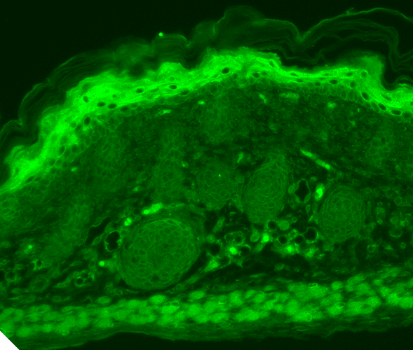 Immunohistochemistry analysis using Mouse Anti-TrpV3 Monoclonal Antibody, Clone N15/4 (11520). Tissue: backskin. Species: Mouse. Fixation: Bouin
