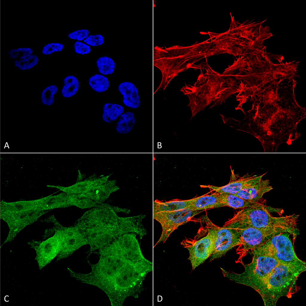 Immunocytochemistry/Immunofluorescence analysis using Mouse Anti-Versican Monoclonal Antibody, Clone S351-23 (56542). Tissue: Neuroblastoma cell line (SK-N-BE). Species: Human. Fixation: 4% Formaldehyde for 15 min at RT. Primary Antibody: Mouse Anti-Versican Monoclonal Antibody (56542) at 1:100 for 60 min at RT. Secondary Antibody: Goat Anti-Mouse ATTO 488 at 1:100 for 60 min at RT. Counterstain: Phalloidin Texas Red F-Actin stain; DAPI (blue) nuclear stain at 1:1000, 1:5000 for 60min RT, 5min RT. Localization: Cytoplasm, Membrane, Extracellular Space, Extracellular Matrix. Magnification: 60X. (A) DAPI (blue) nuclear stain. (B) Phalloidin Texas Red F-Actin stain. (C) Versican Antibody. (D) Composite.