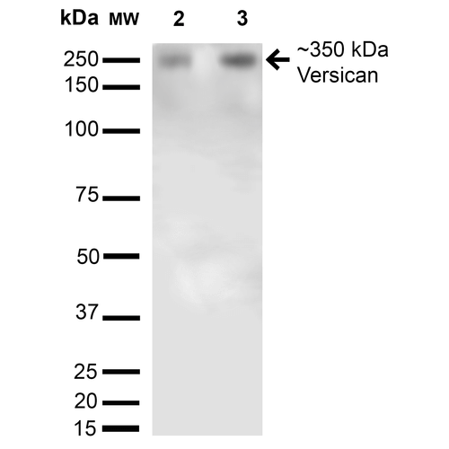 Western Blot analysis of Rat Brain Membrane and brain showing detection of 350kDa Versican protein using Mouse Anti-Versican Monoclonal Antibody, Clone S351-23 (56542). Lane 1: Molecular Weight Ladder. Lane 2: Rat Brain Membrane and brain. Load: 15 µg. Block: 5% Skim Milk in 1X TBST. Primary Antibody: Mouse Anti-Versican Monoclonal Antibody (56542) at 1:200 for 16 hours at 4°C. Secondary Antibody: Goat Anti-Mouse IgG: HRP at 1:1000 for 1 hour RT. Color Development: KPL TMB. Predicted/Observed Size: 350kDa. Other Band(s): Multiple other bands.