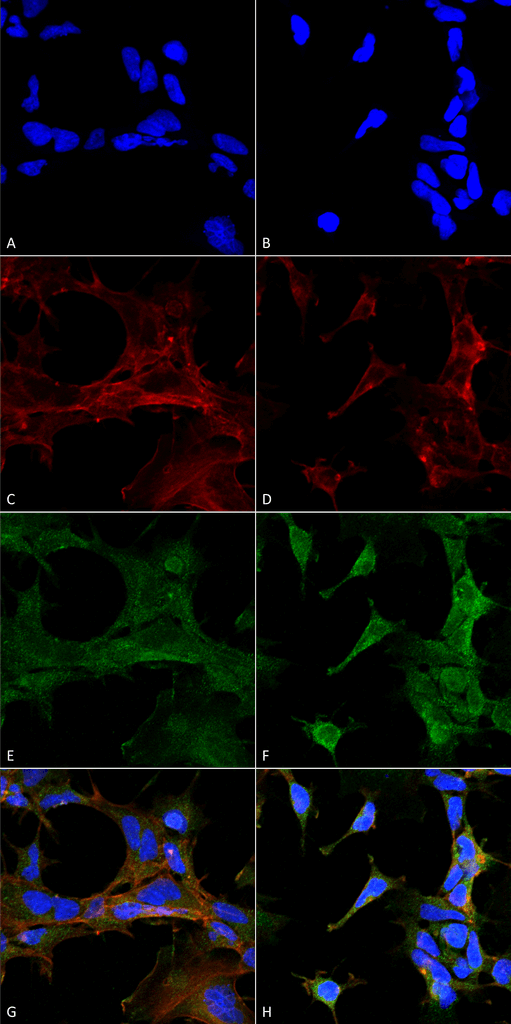 Immunocytochemistry/Immunofluorescence analysis using Mouse Anti-4-Hydroxy-2-hexenal Monoclonal Antibody, Clone 6F10 . Tissue: Embryonic kidney epithelial cell line (HEK293). Species: Human. Fixation: 5% Formaldehyde for 5 min. Primary Antibody: Mouse Anti-4-Hydroxy-2-hexenal Monoclonal Antibody at 1:400 for 30-60 min at RT. Secondary Antibody: Goat Anti-Mouse Alexa Fluor 488 at 1:1500 for 30-60 min at RT. Counterstain: Phalloidin Alexa Fluor 633 F-Actin stain; DAPI (blue) nuclear stain at 1:250, 1:50000 for 30-60 min at RT. Magnification: 20X (2X Zoom). (A,C,E,G) - Untreated. (B,D,F,H) - Cells cultured overnight with 50 µM H2O2. (A,B) DAPI (blue) nuclear stain. (C,D) Phalloidin Alexa Fluor 633 F-Actin stain. (E,F) 4-Hydroxy-2-hexenal Antibody. (G,H) Composite. Courtesy of: Dr. Robert Burke, University of Victoria.
