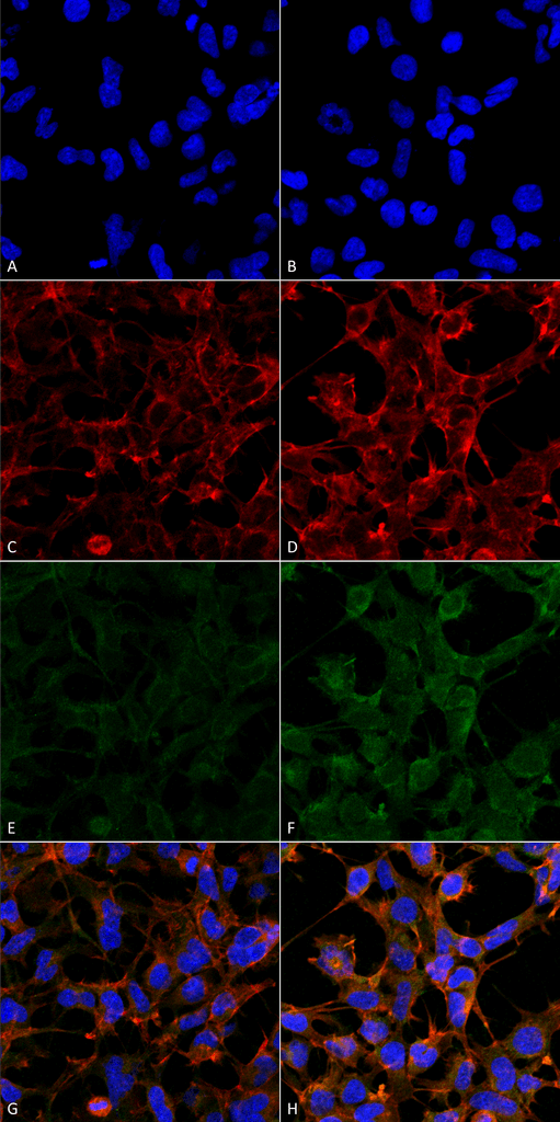Immunocytochemistry/Immunofluorescence analysis using Mouse Anti-4-Hydroxynonenal Monoclonal Antibody, Clone 12F7 . Tissue: Embryonic kidney epithelial cell line (HEK293). Species: Human. Fixation: 5% Formaldehyde for 5 min. Primary Antibody: Mouse Anti-4-Hydroxynonenal Monoclonal Antibody at 1:50 for 30-60 min at RT. Secondary Antibody: Goat Anti-Mouse Alexa Fluor 488 at 1:1500 for 30-60 min at RT. Counterstain: Phalloidin Alexa Fluor 633 F-Actin stain; DAPI (blue) nuclear stain at 1:250, 1:50000 for 30-60 min at RT. Magnification: 20X (2X Zoom). (A,C,E,G) - Untreated. (B,D,F,H) - Cells cultured overnight with 50 µM H2O2. (A,B) DAPI (blue) nuclear stain. (C,D) Phalloidin Alexa Fluor 633 F-Actin stain. (E,F) 4-Hydroxynonenal Antibody. (G,H) Composite. Courtesy of: Dr. Robert Burke, University of Victoria.